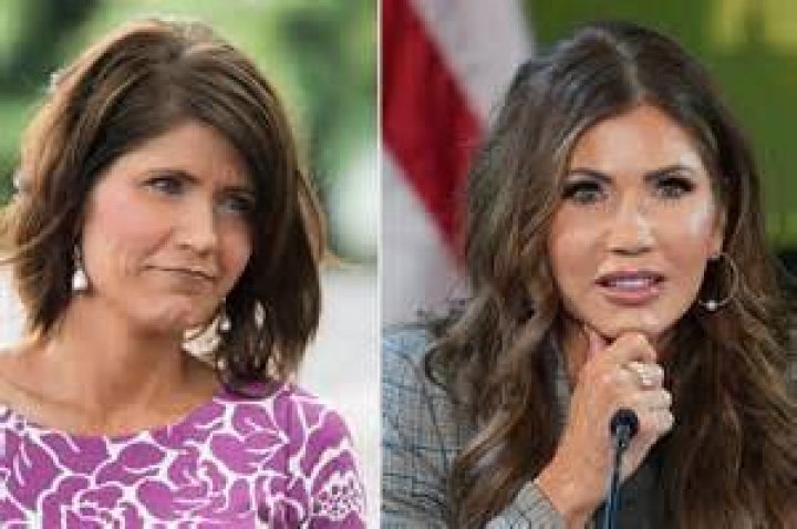 Kristi Noem's Transformation: Exploring the Evolution of Her Lips and Cosmetic Procedures