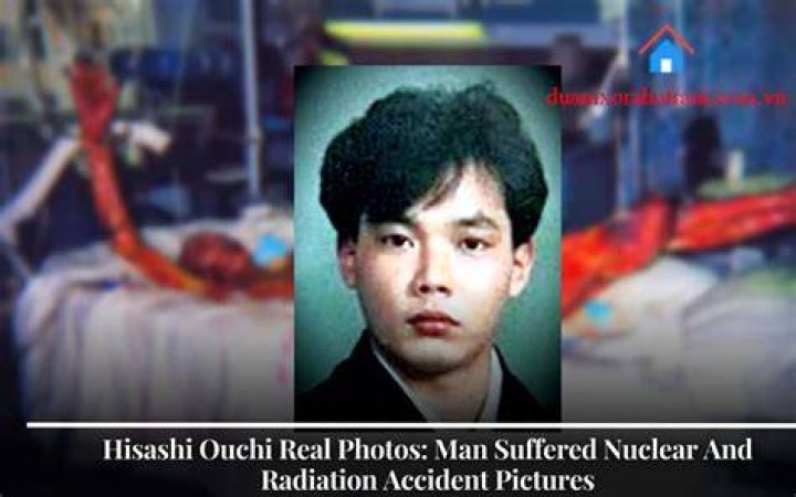 Real Hisashi Ouchi Photos: Exploring the Life and Legacy of a Tragic Incident